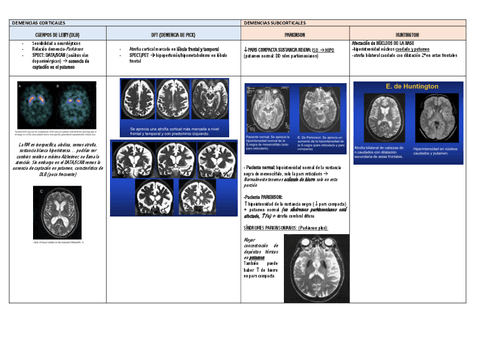 tabla-radiologia-demencias.pdf