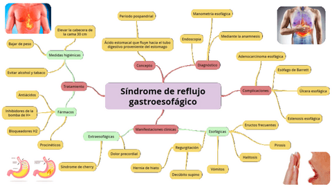 Sindrome-de-reflujo-gastroesofagico-Mapa-conceptual.pdf