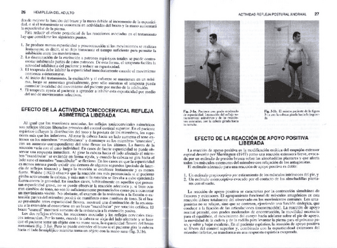 S-bobathhemiplejiadeladulto-2.pdf