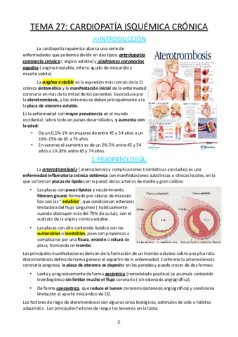 Tema 27 crdiopatía isuqémica crónica.pdf