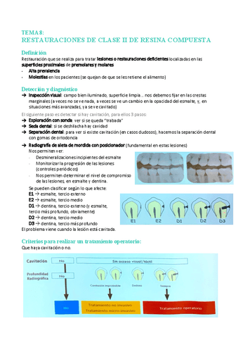 Tema-1-Restauraciones-de-clase-II-RC.pdf