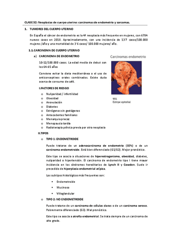 Tema-32.-Neoplasias-de-cuerpo-uterino.pdf