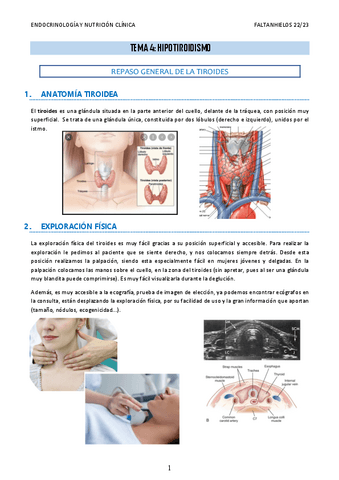 4.-Hipotiroidismo.pdf