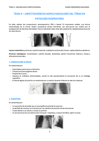 TEMA-9-ASPECTOS-BASICOS-ACERCA-RADIOLOGIA-DEL-TORAX-EN-PATOLOGIA-RESPIRATORIA.pdf
