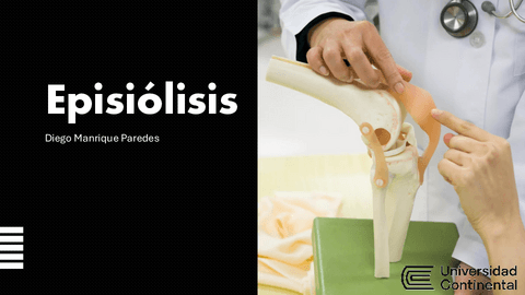 Epifisiolisis-Traumatologia.pdf