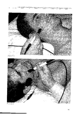 Electroterapia-en-Fisioterapia-2da-Ed-by-Jose-Maria-Rodriguez-Martin-z-liborg-23.pdf