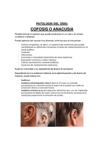 anacusia-patologia-oido.pdf