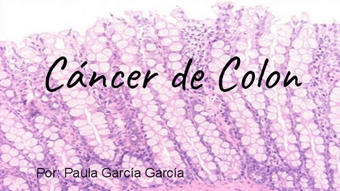 Trabajo-Cancer-de-Colon.pdf