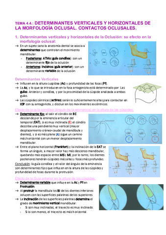 Tema-4.4.-Determinantes-verticales-y-horizontales.-Contactos-oclusales..pdf