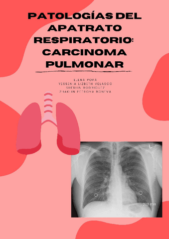 TrabajoCarcinomaPulmonar.pdf