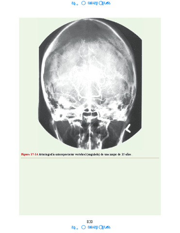 Neuroanatomia-Clinica-Snell-7a-Edicionbooksmedicosorg-64.pdf