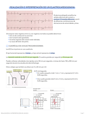 REALIZACION-E-INTERPRETACION-DE-UN-ECG.pdf