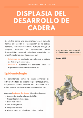 Displasia-del-desarrollo-de-cadera.pdf