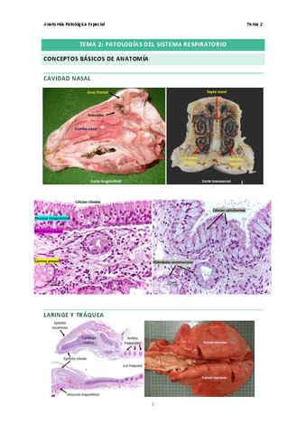 Tema-2.-Patologias-del-Sistema-Respiratorio.pdf