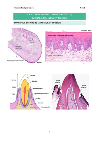 Tema-3.-Patologias-del-Sistema-Digestivo-I-y-II.pdf