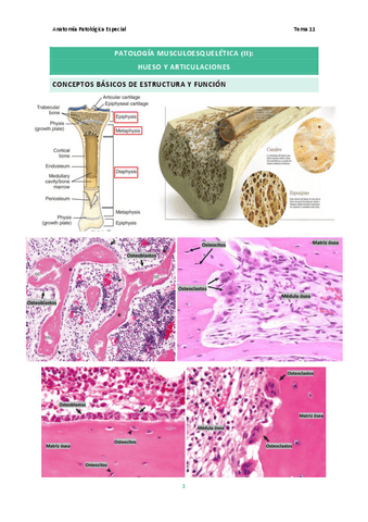 Tema-11.-Patologia-Musculoesqueletica-II.pdf