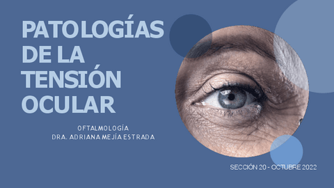 GLAUCOMA.pdf