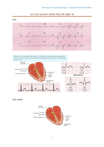 ecgwavesunit9.5.pdf