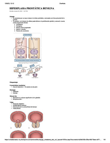 Hiperplasia-prostatica-benigna.pdf