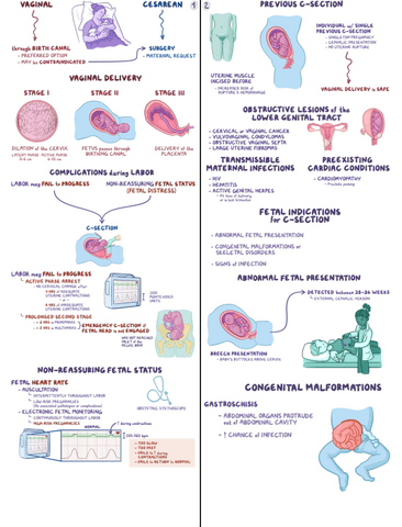 Vaginal-Vs-Cesarean-Delivery-Clinical-Reasoning.pdf