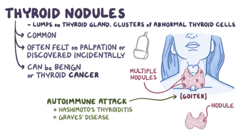 Nodulos-Tiroideos-Clinical-Reasoning.pdf