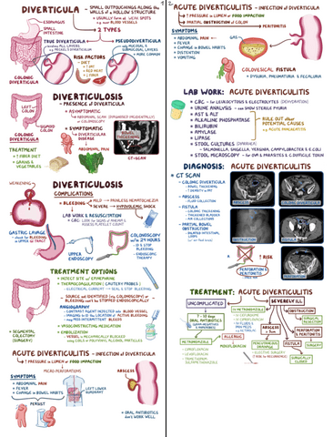 Diverticula-Clinical-Reasoning.pdf