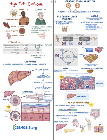 High-Yield-Cirrhosis.pdf