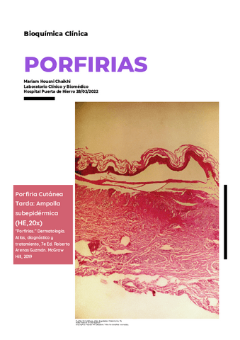 Trabajo bioquímica escrito y Ppt.pdf