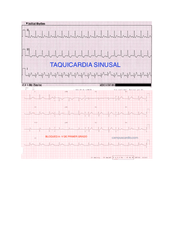 Fotos-tipos-ECG.pdf