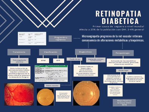 Retinopatia-diabetica.pdf