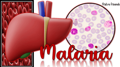 MALARIA RESUMEN.pdf