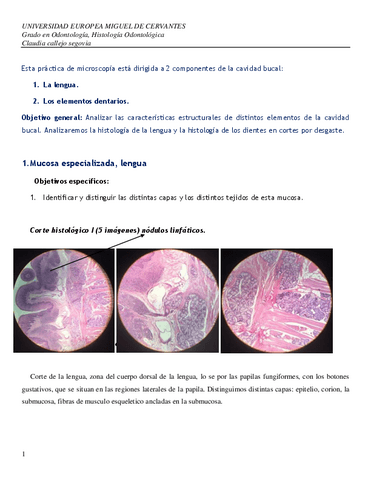 Practica-lengua-y-dientes-cortes-desgaste-claudia-callejo-segovia.pdf