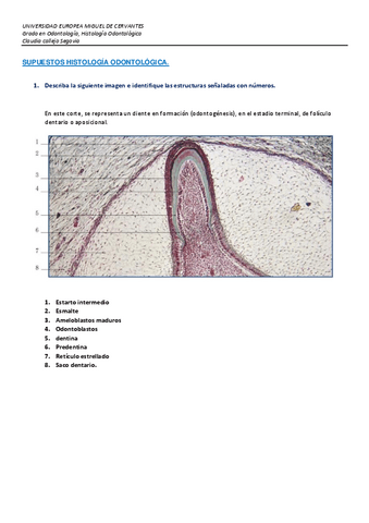Supuestos-Histologia-Odontologica-Claudia-callejo-segovia.pdf