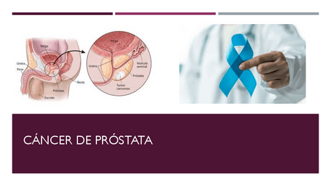 Cancer-de-prostata.pdf
