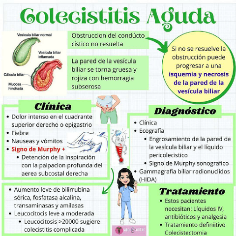 COLECISTITIS-AGUDA.pdf