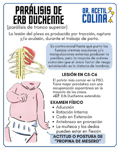 Paralisis-de-Erb-Duchenne.pdf