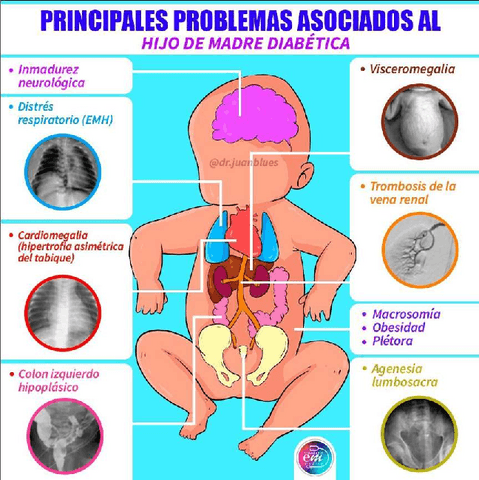 Problemas-de-Hijos-de-Madre-Diabetica.pdf