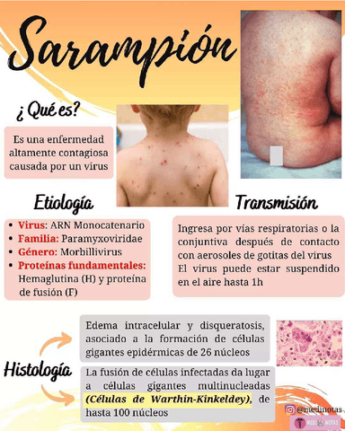 SARAMPION.pdf