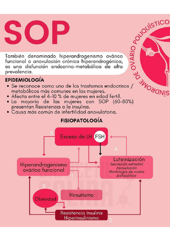 SINDROME-DE-OVARIO-POLIQUISTICO.pdf