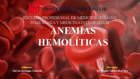 Anemia-hemolitica.pdf