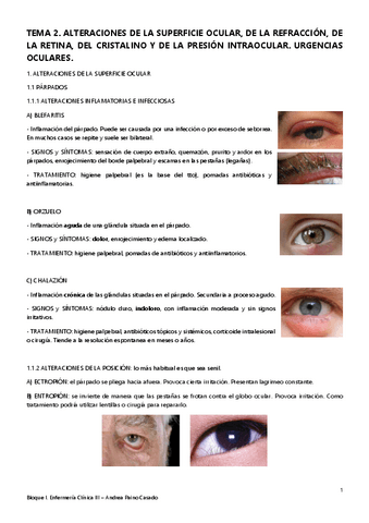 Tema-2.-Alteraciones-de-la-superficie-ocular-de-la-refraccion-de-la-retina.pdf