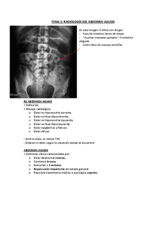 TEMA-2-RAYOS-ABDOMEN-AGUDO..pdf