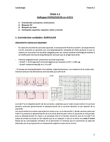 TEMA-4.2-ECG.pdf
