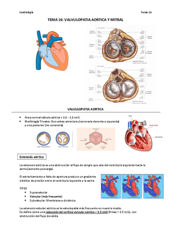 TEMA-16-VALVULOPATIA-AORTICA-Y-MITRAL.pdf