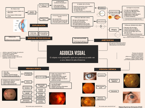 Agudeza-visual-Perdida-de-la-vision-y-Ametropias.pdf