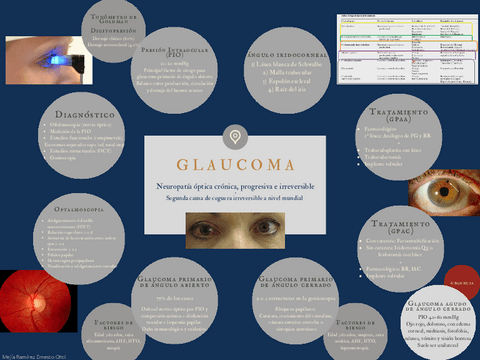 Glaucoma-Oftalmo.pdf
