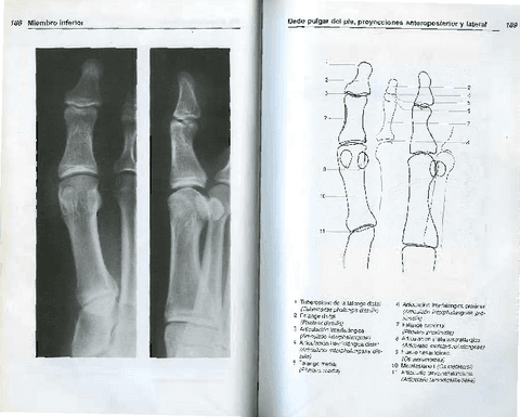 AnatomiaRadiologica-TorstenBMoller-8.pdf