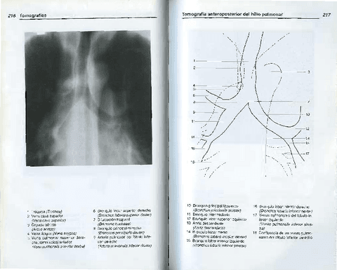 AnatomiaRadiologica-TorstenBMoller-9.pdf