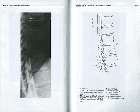 AnatomiaRadiologica-TorstenBMoller-13.pdf