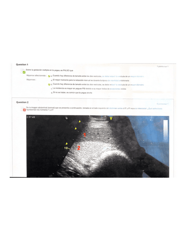 Examen-TEORIA-I-JULIO-2023-Respondus.pdf